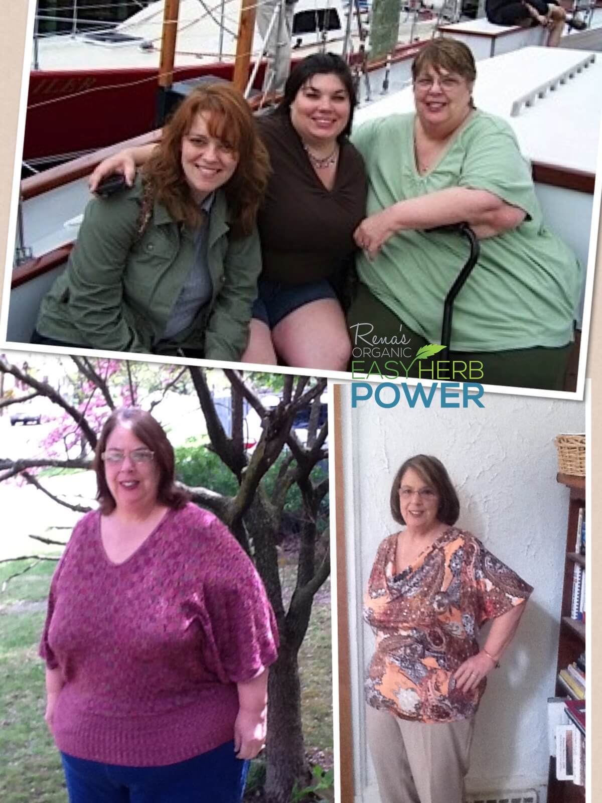 Cathy Loses 93 Lbs In 8 Months After Gastric Bypass Hypnosis 